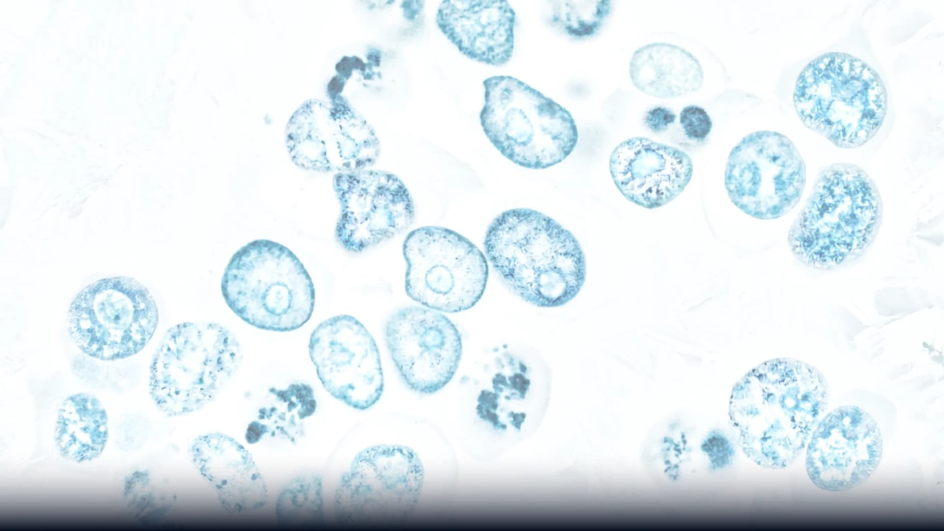 Fluorescent microscopy of therapeutic cells